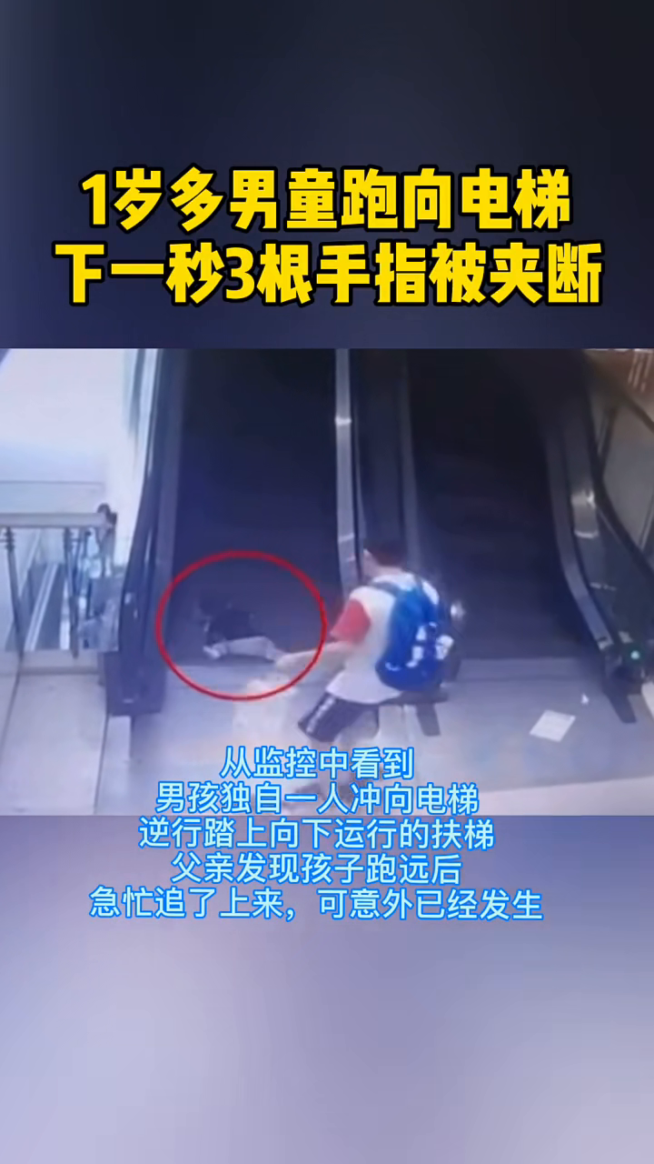 惊！男童遭遇电梯无情夹击，手指断折事件引发社会关注