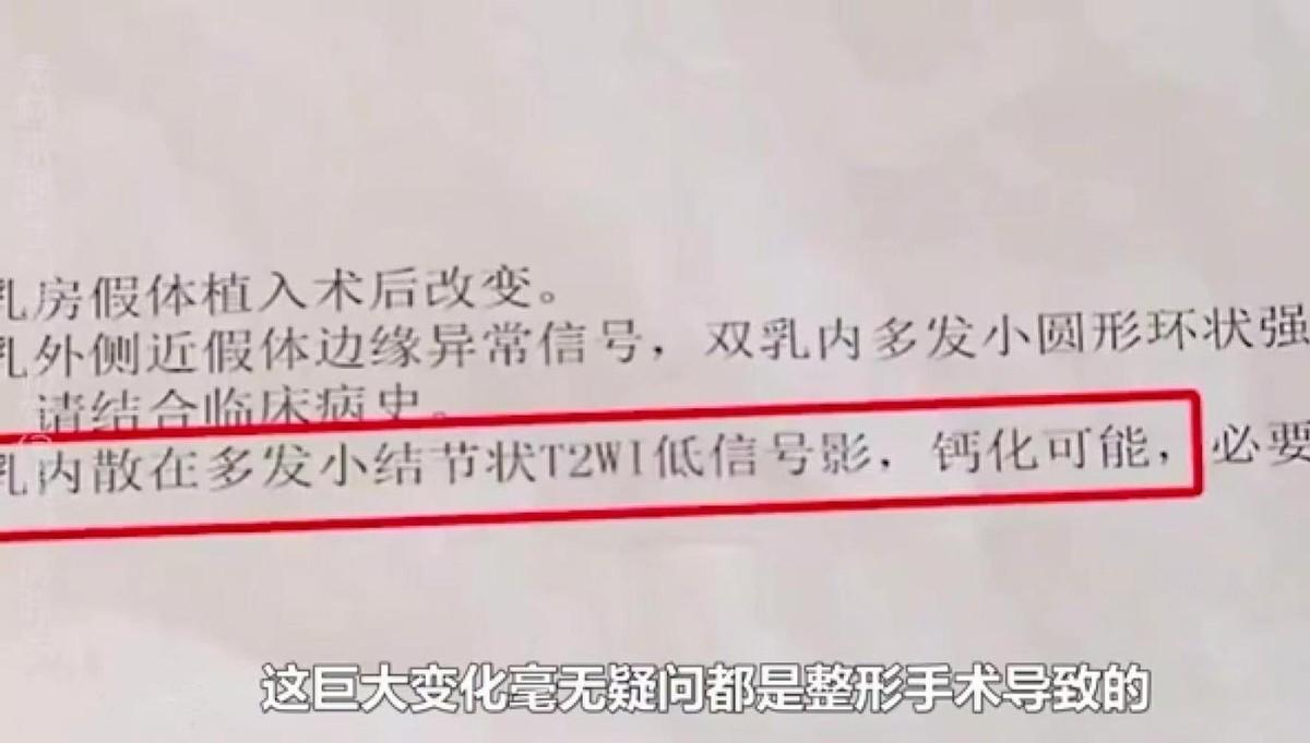 惊！女子私密手术后竟头晕嘴歪，医院回应引争议，真相令人倒吸一口凉气！